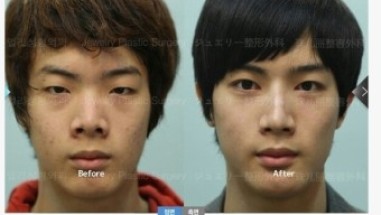 얼쭉아